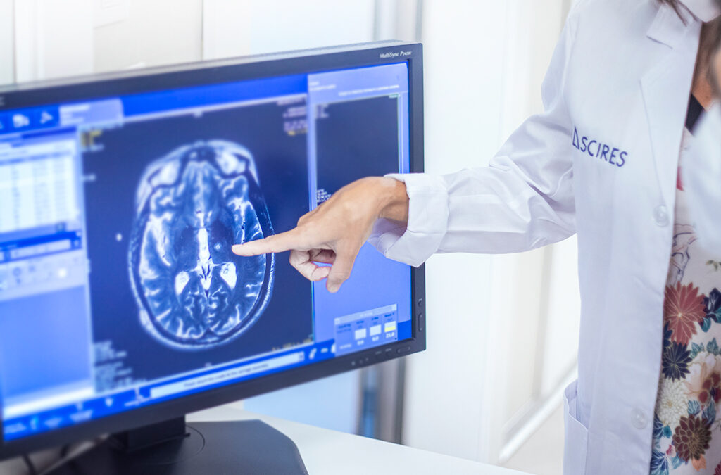 Párkinson y parkinsonismos atípicos: cómo acertar en el diagnóstico