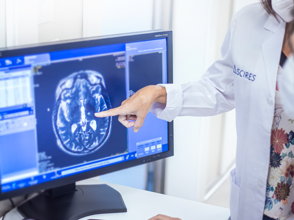 El párkinson y los parkinsonismos atípicos requieren de un diagnóstico preciso ya que en etapas iniciales se pueden confundir.