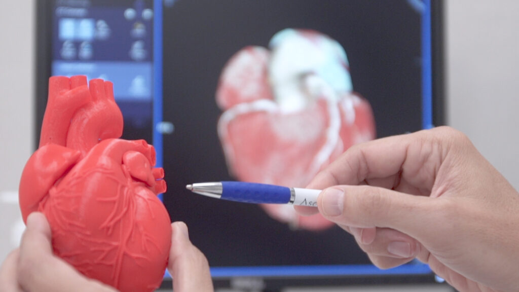 El estudio sobre deporte y riesgo cardiaco en el que ha participado Ascires ha sido el ganador del Premio Nacional de Investigación en Medicina del Deporte en 2022.